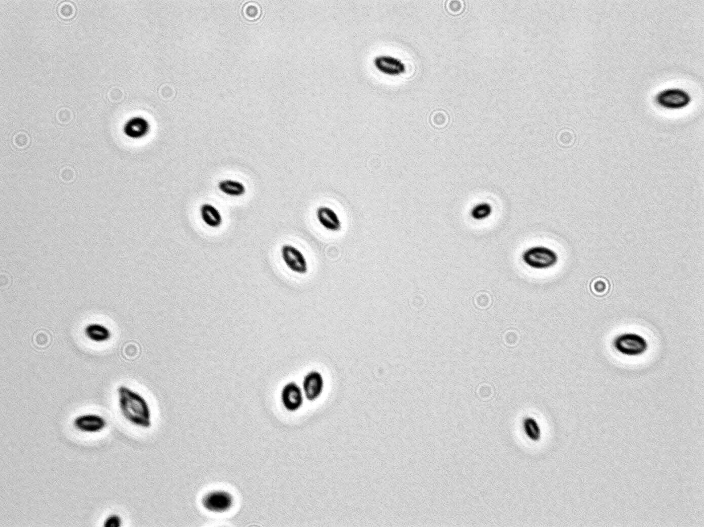 Hanseniaspora uvarum