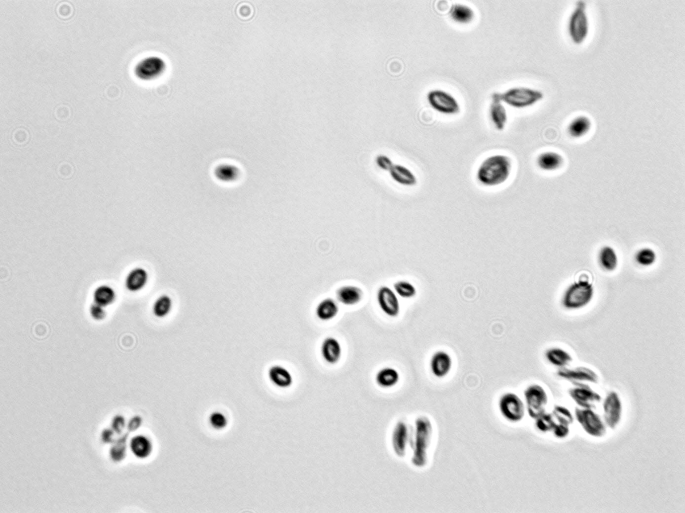 Hanseniaspora uvarum