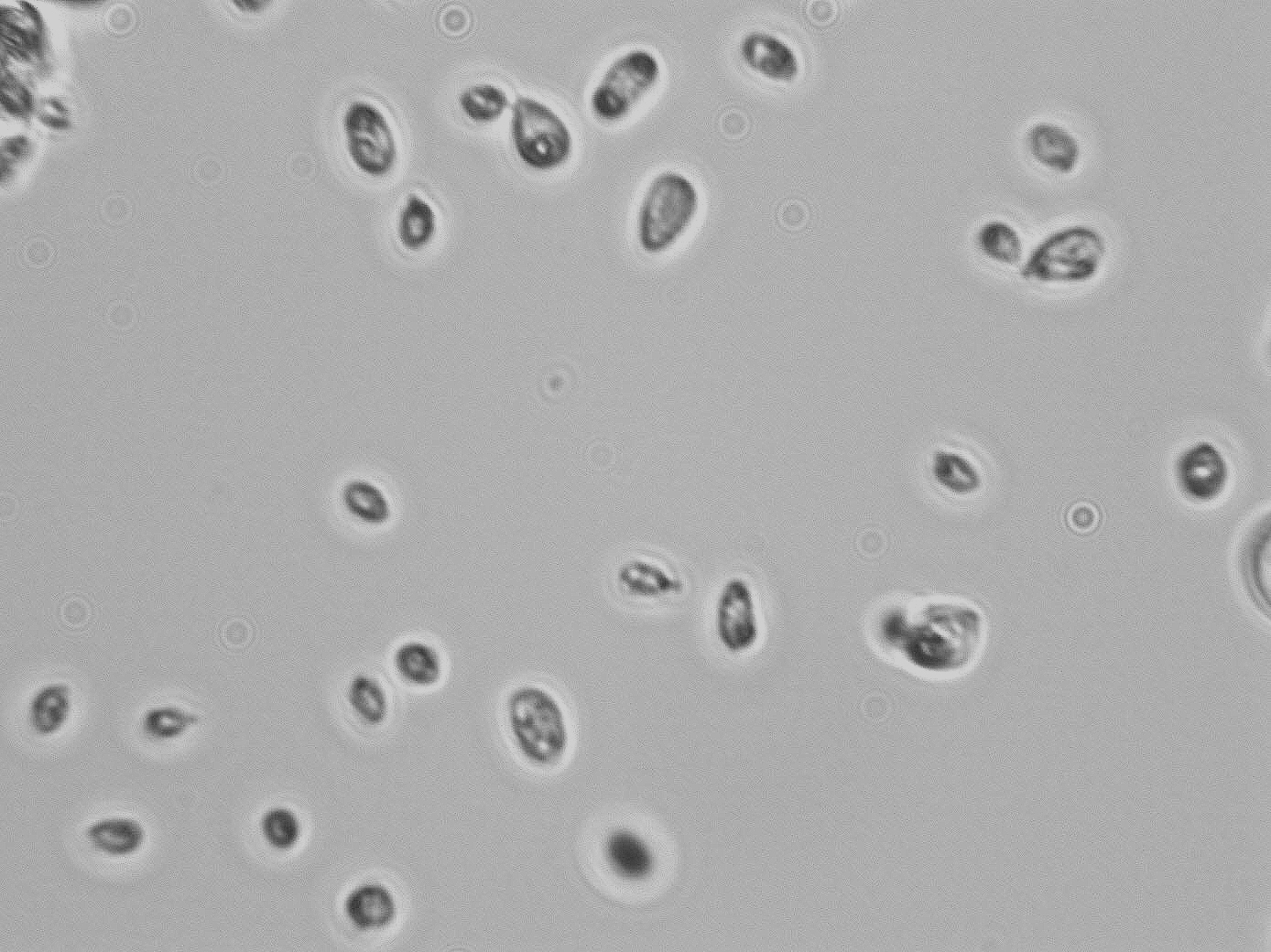 Cryptococcus laurentii