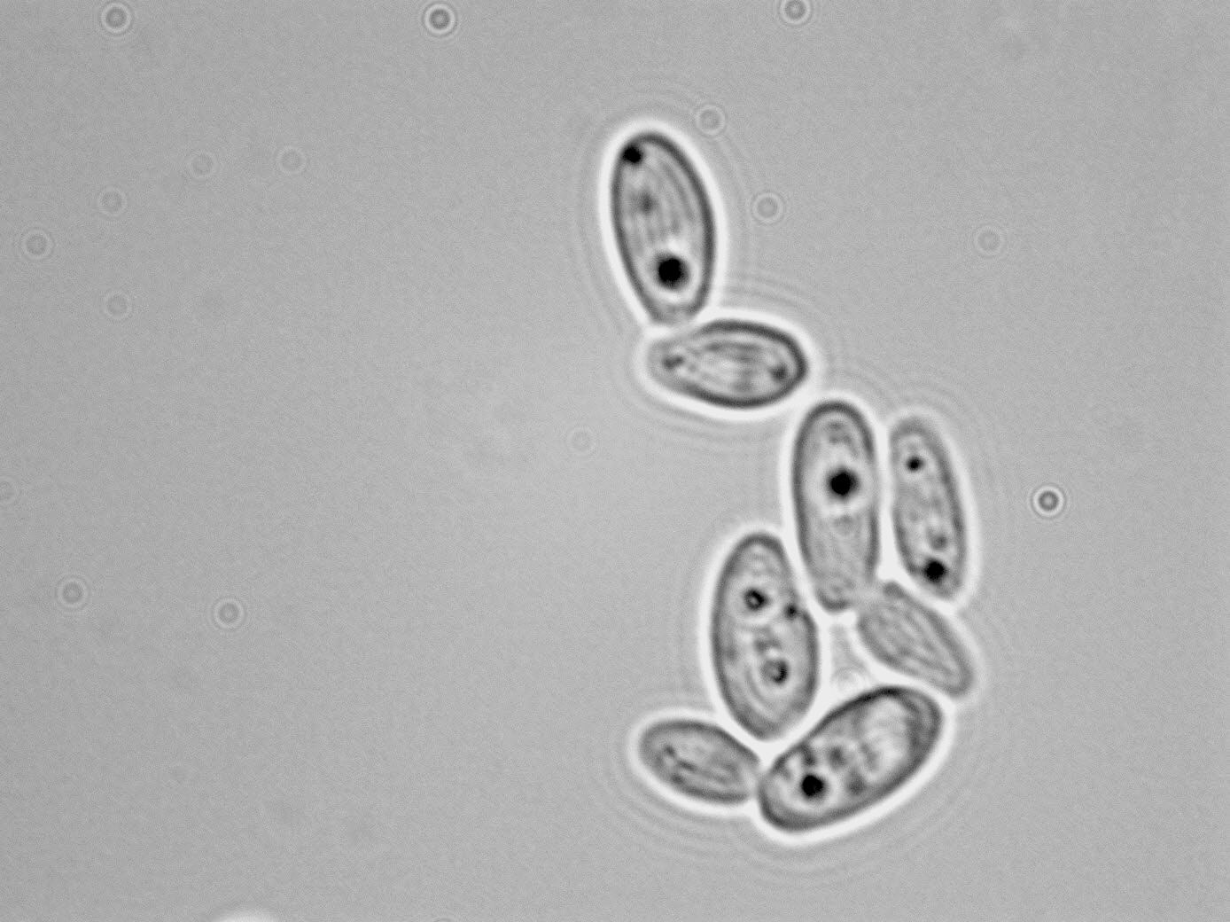 Candida vini