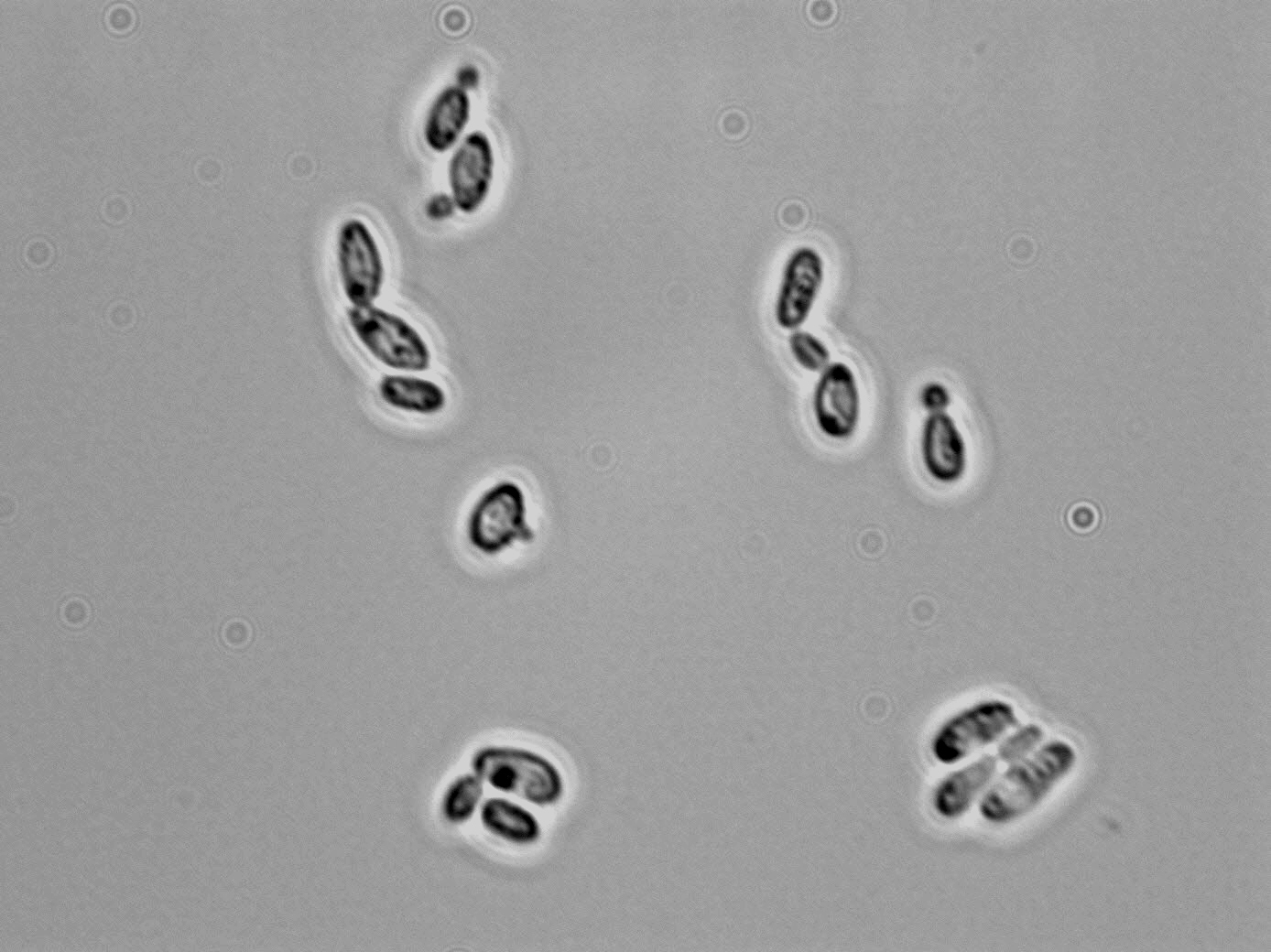 Candida vini