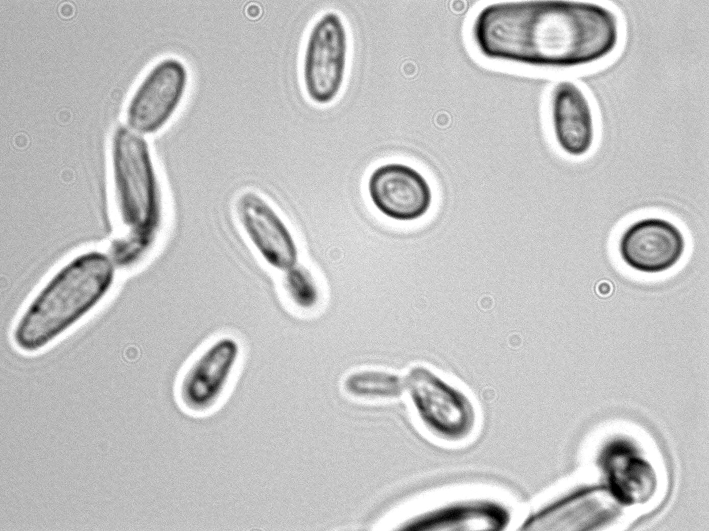 Dekkera bruxellensis
