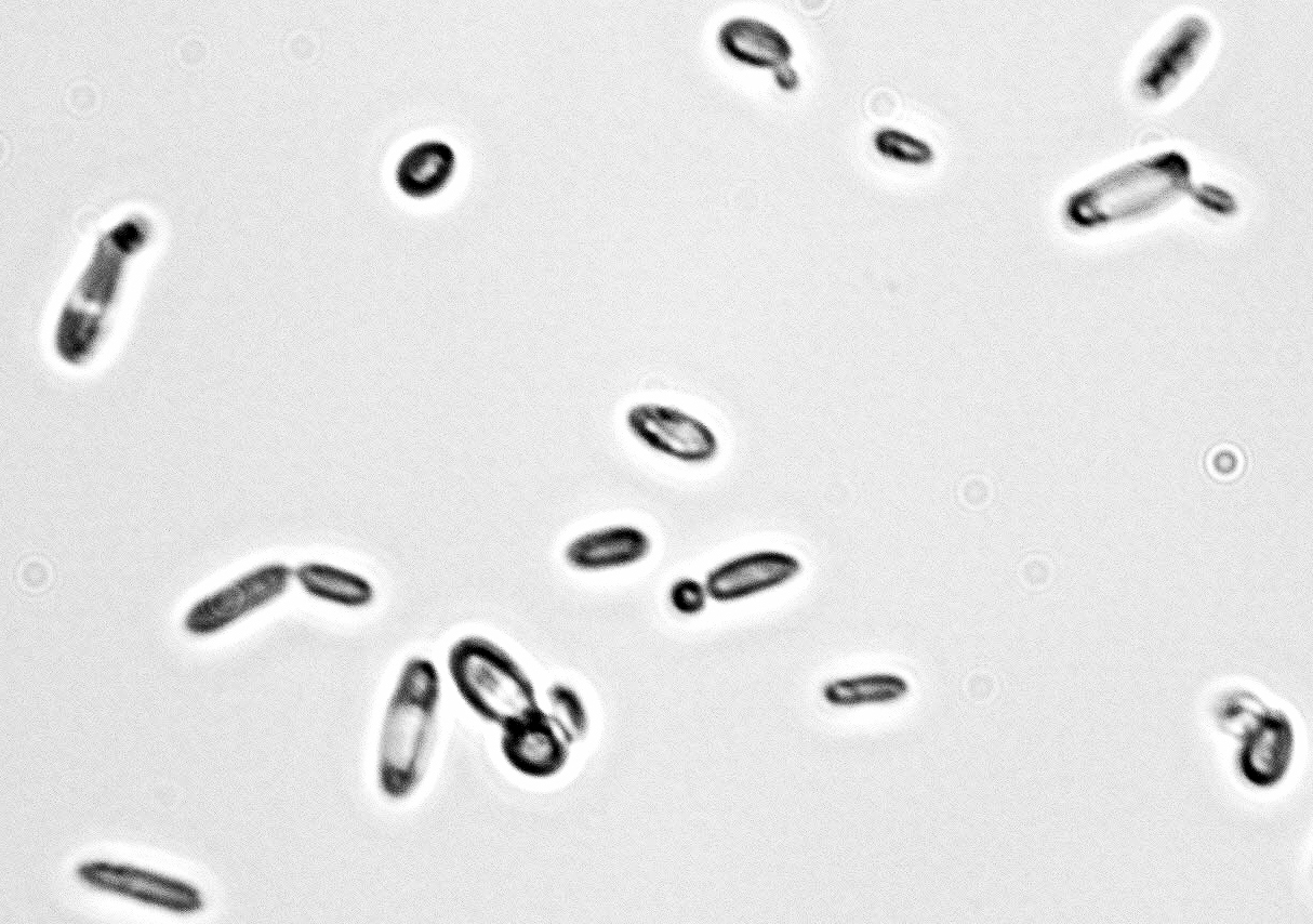 Dekkera bruxellensis