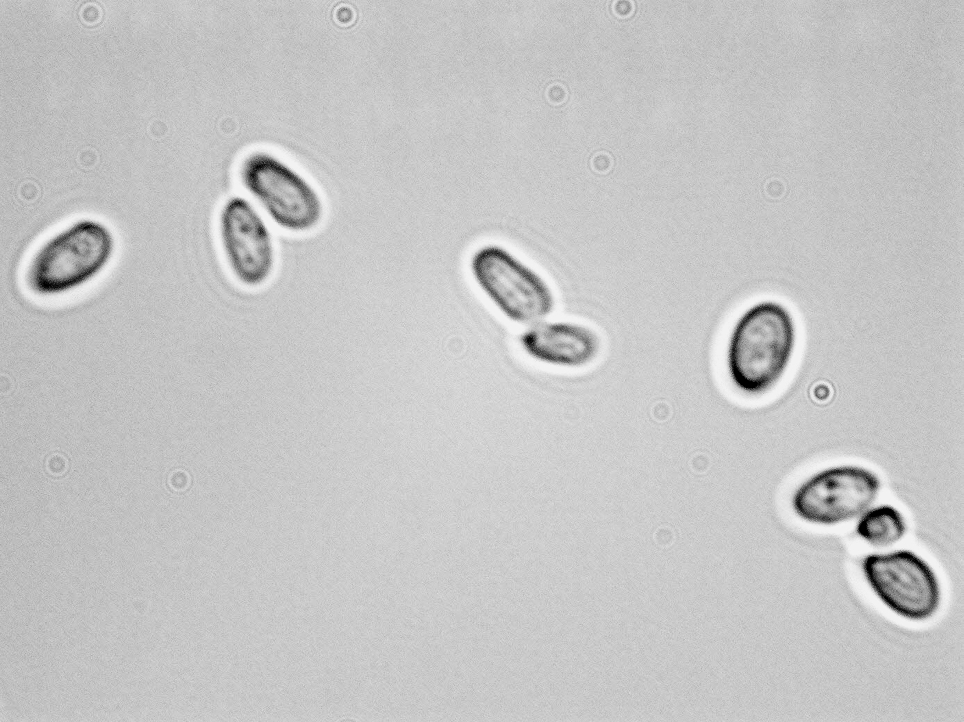 Candida zemplinina