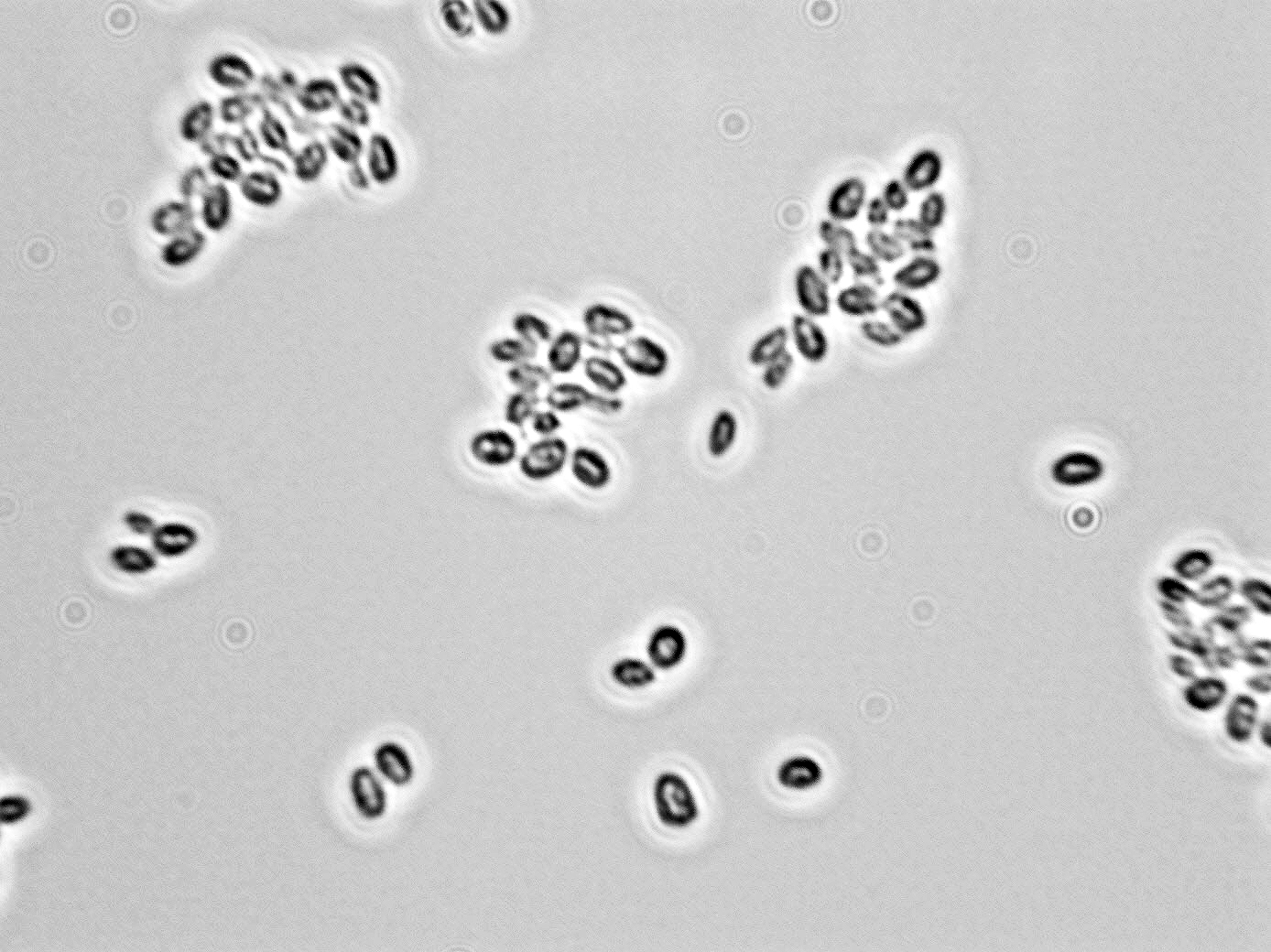 Candida zemplinina