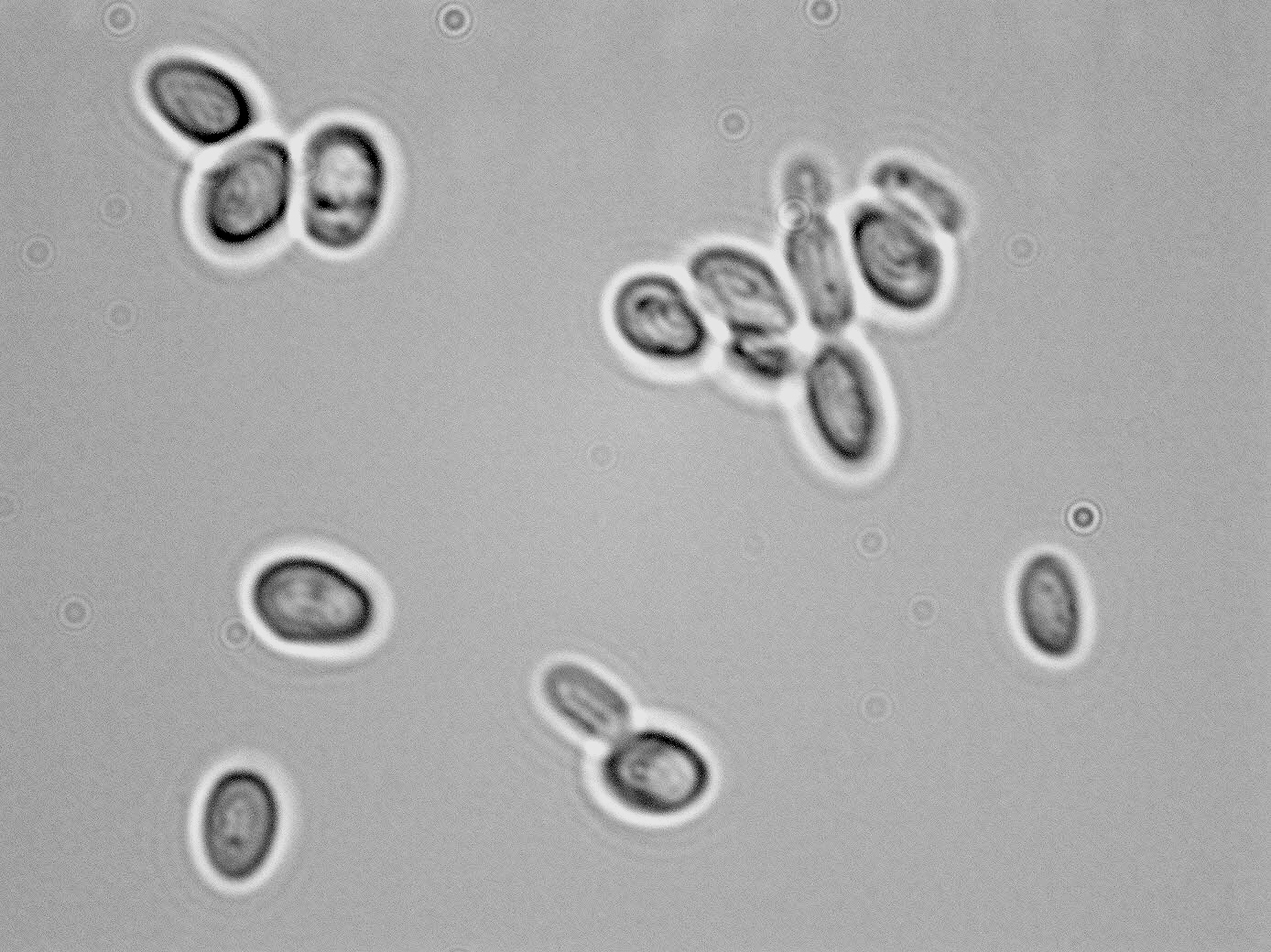 Candida zemplinina