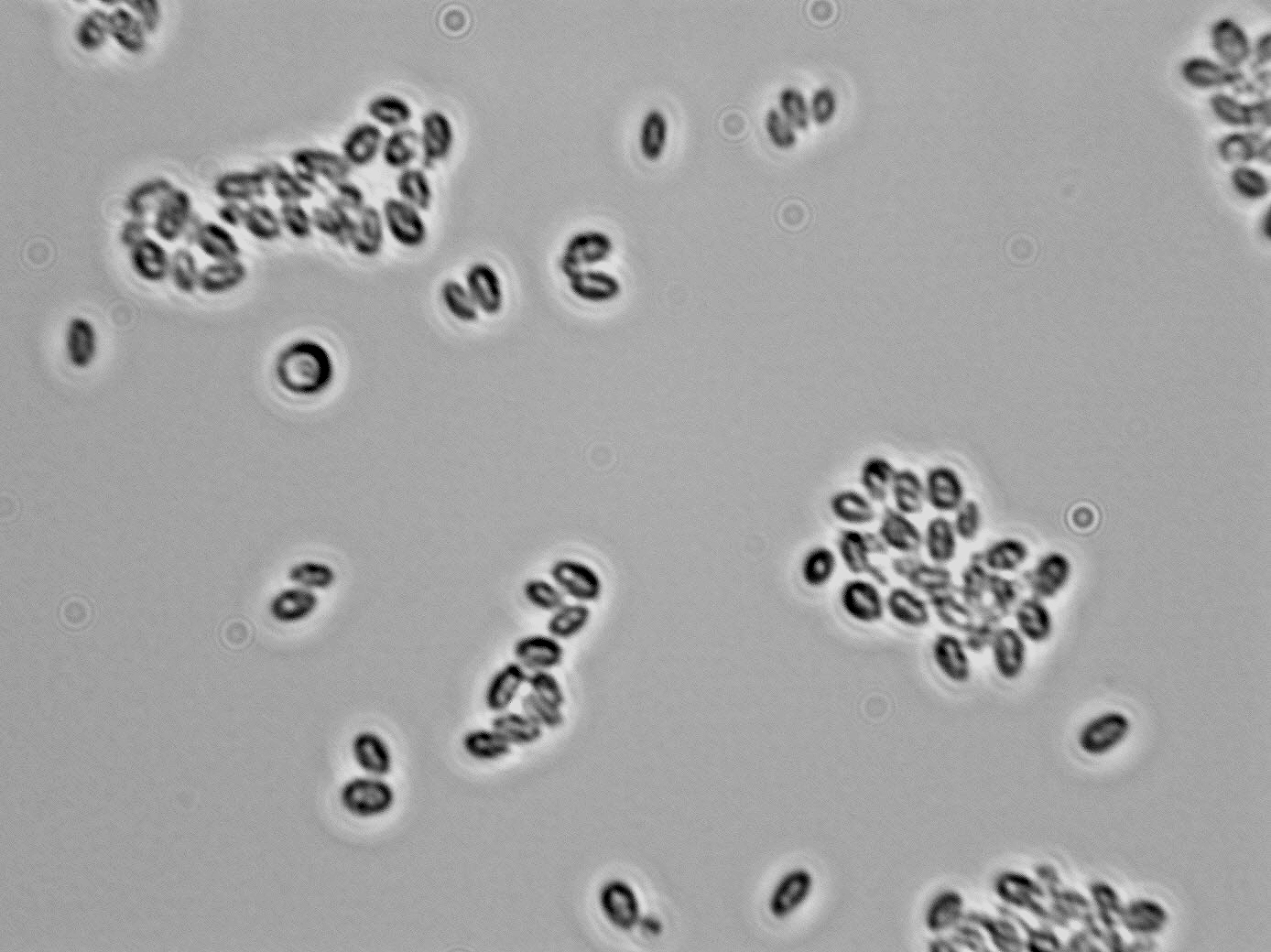 Candida zemplinina