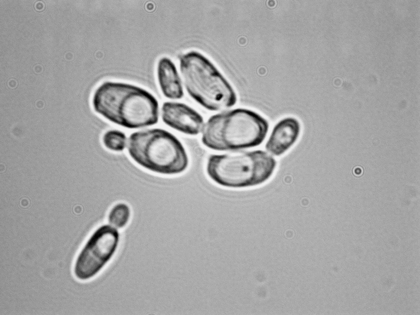 Issatchenkia terricola