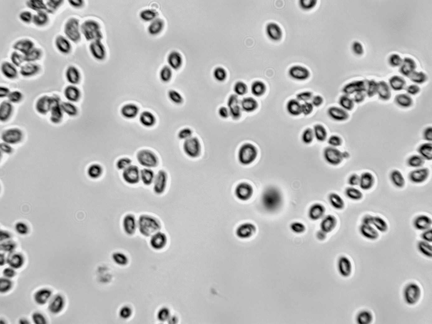 Saccharomyces cerevisiae