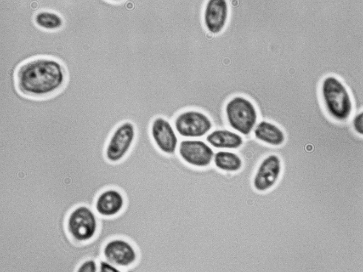 Saccharomyces cerevisiae