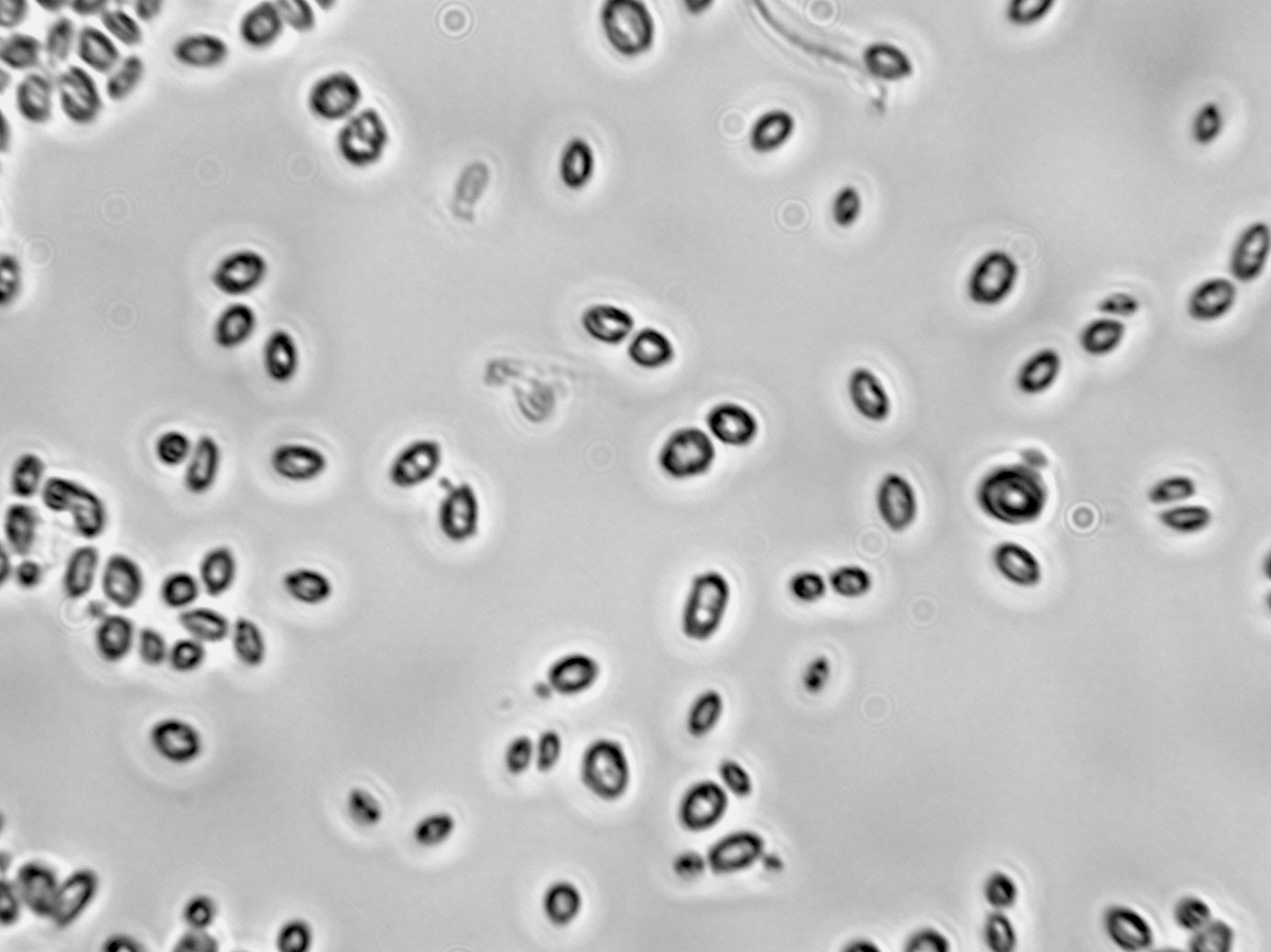 Saccharomyces cerevisiae