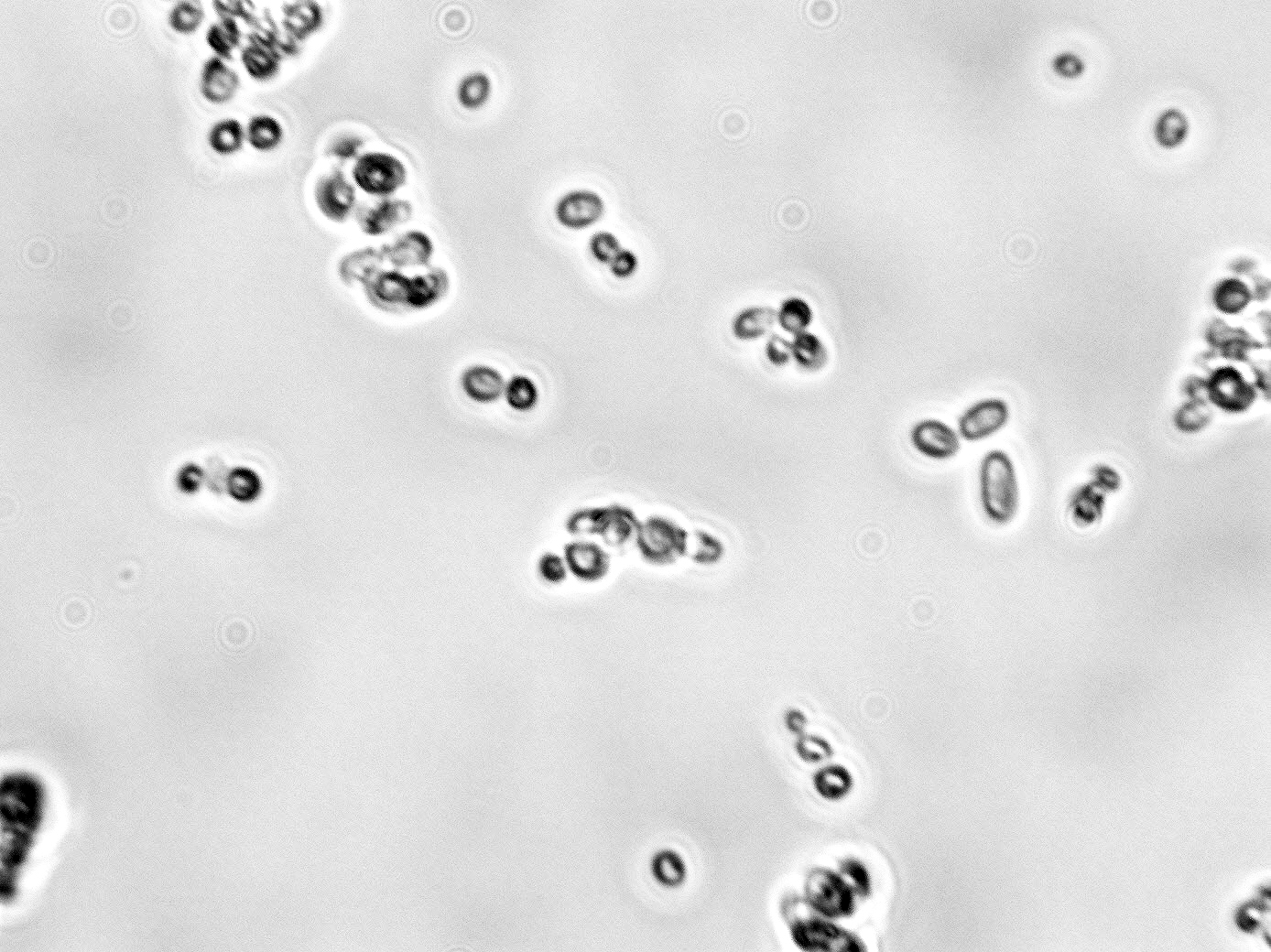Pichia anomala