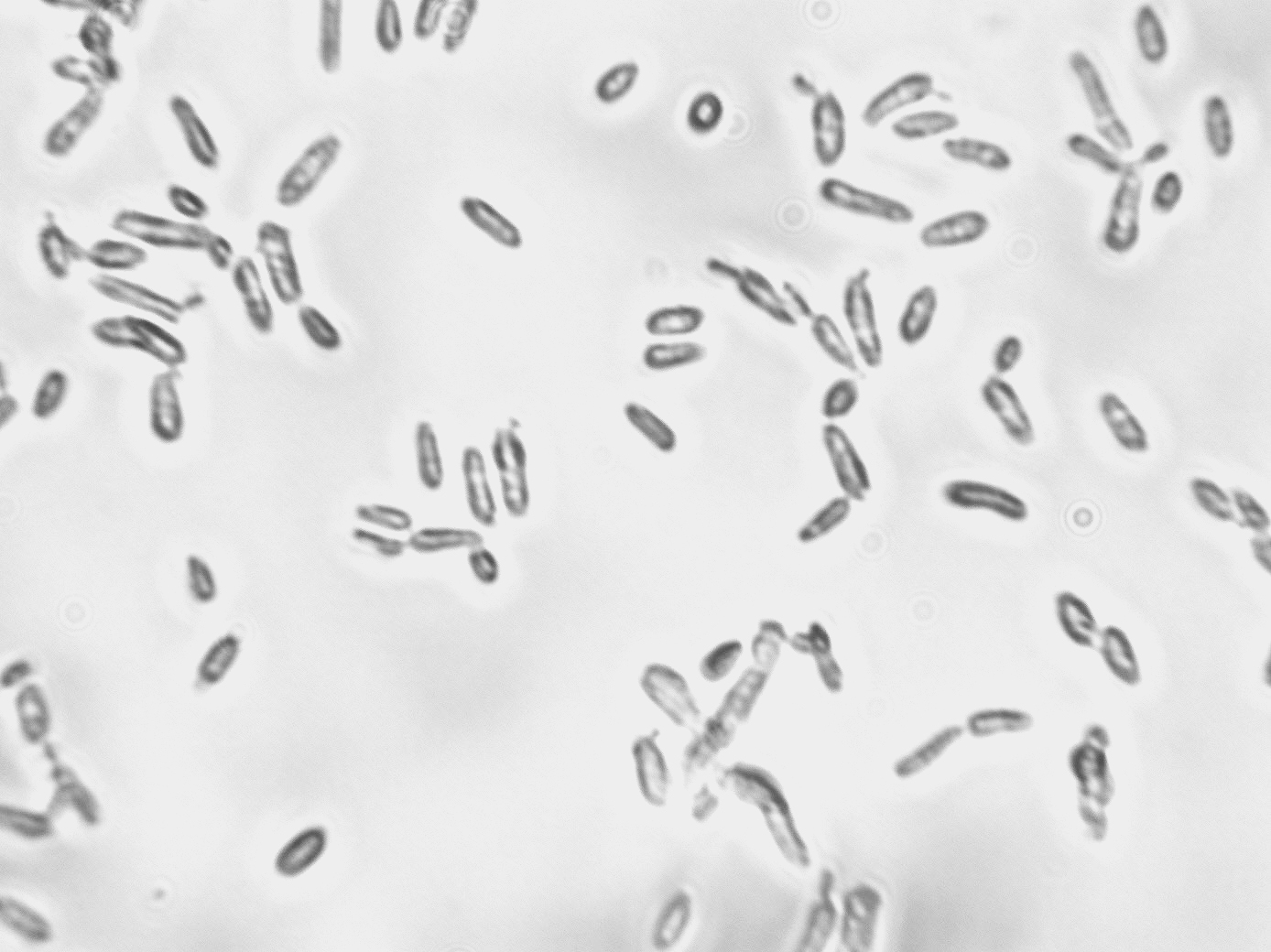 Saccharomyces bayanus