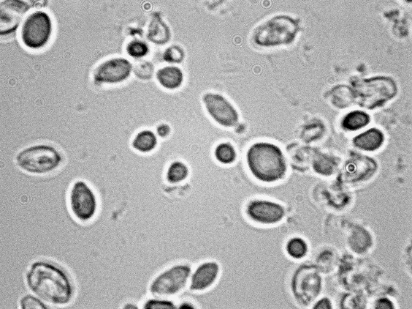 Kluyveromyces marxianus