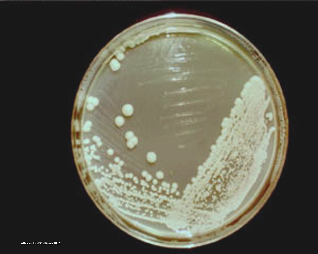 saccharomyces palte