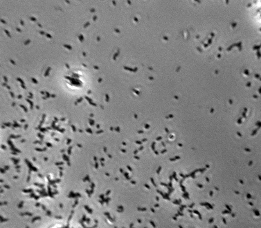 Acetobacter lovaniensis