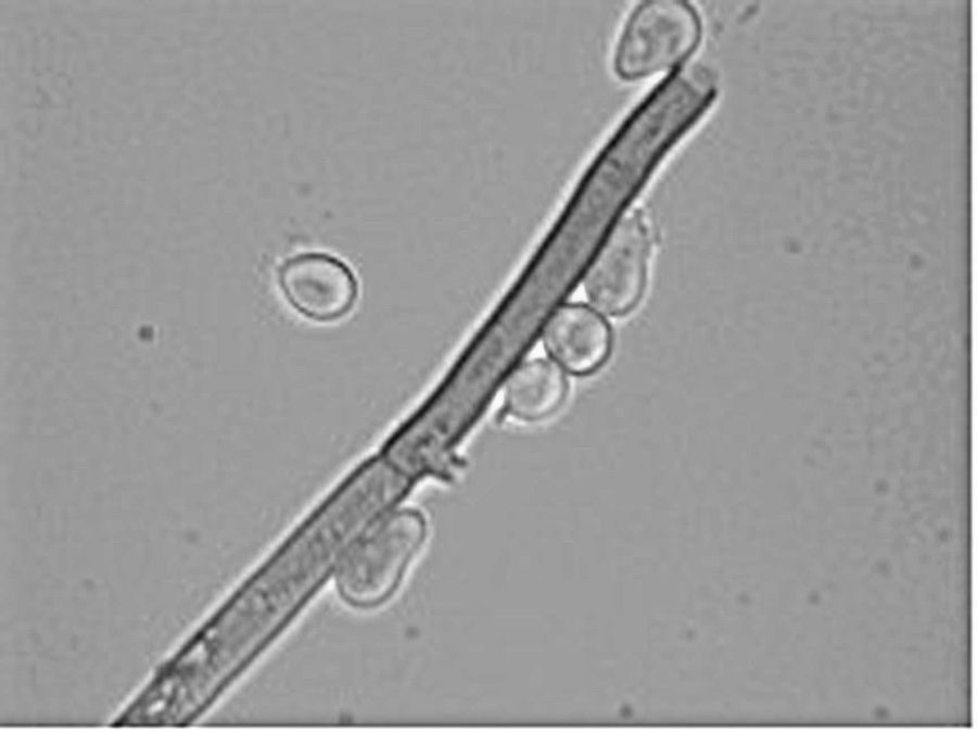 Botrytis cinerea spores at 400x maginfication