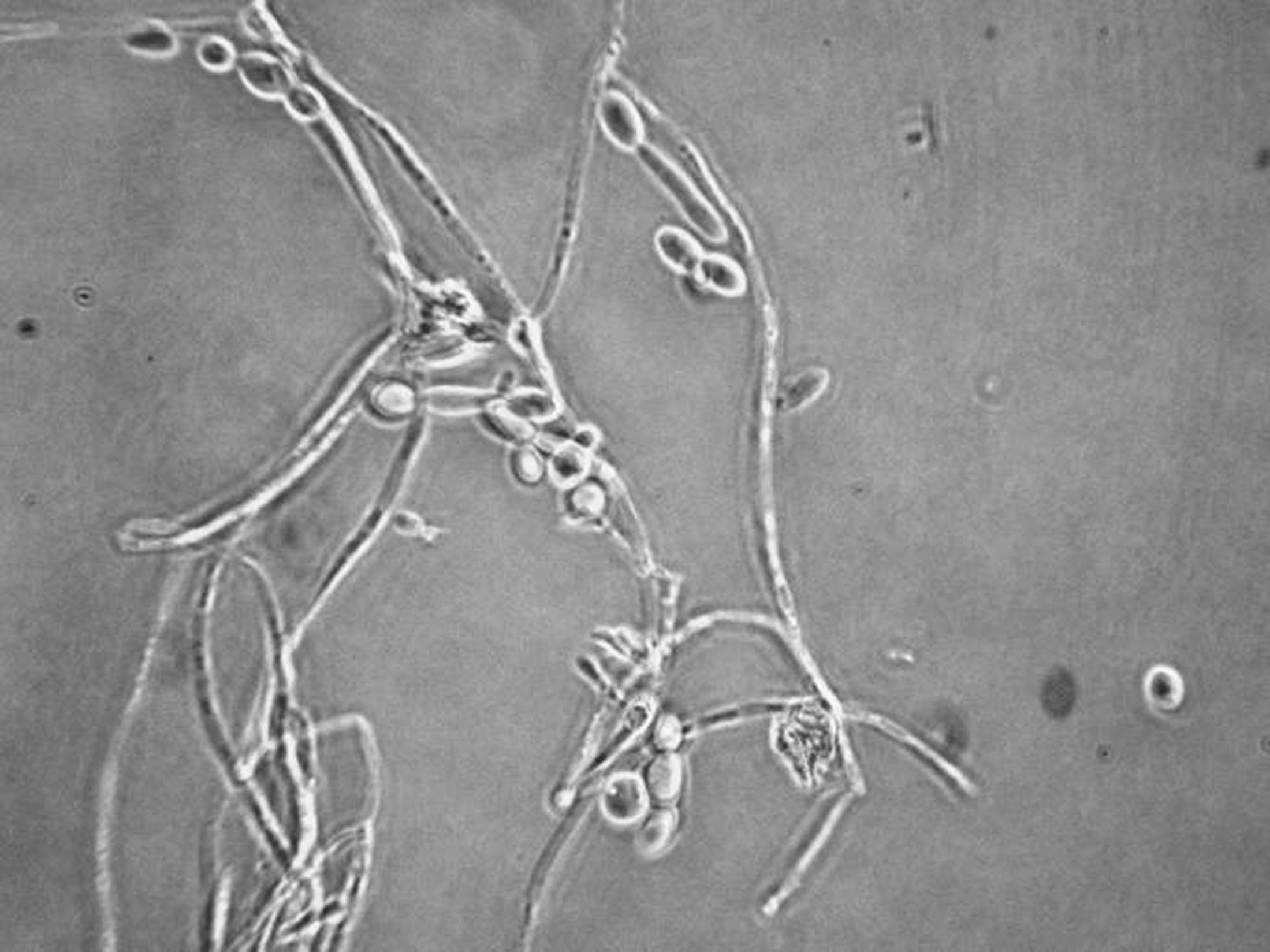 Brettanomyces bruxellensis 1000x