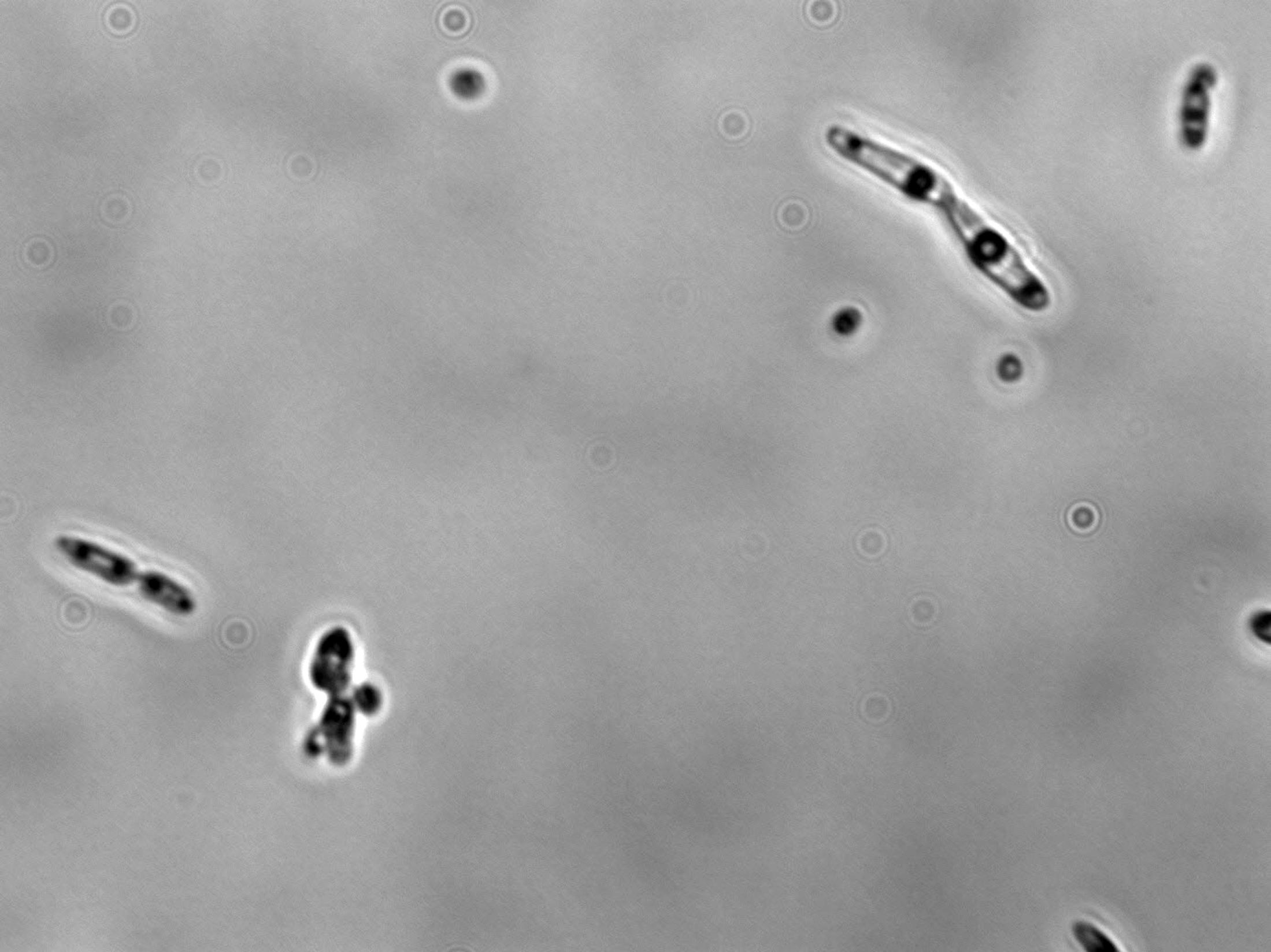 Candida intermedia at 1000x