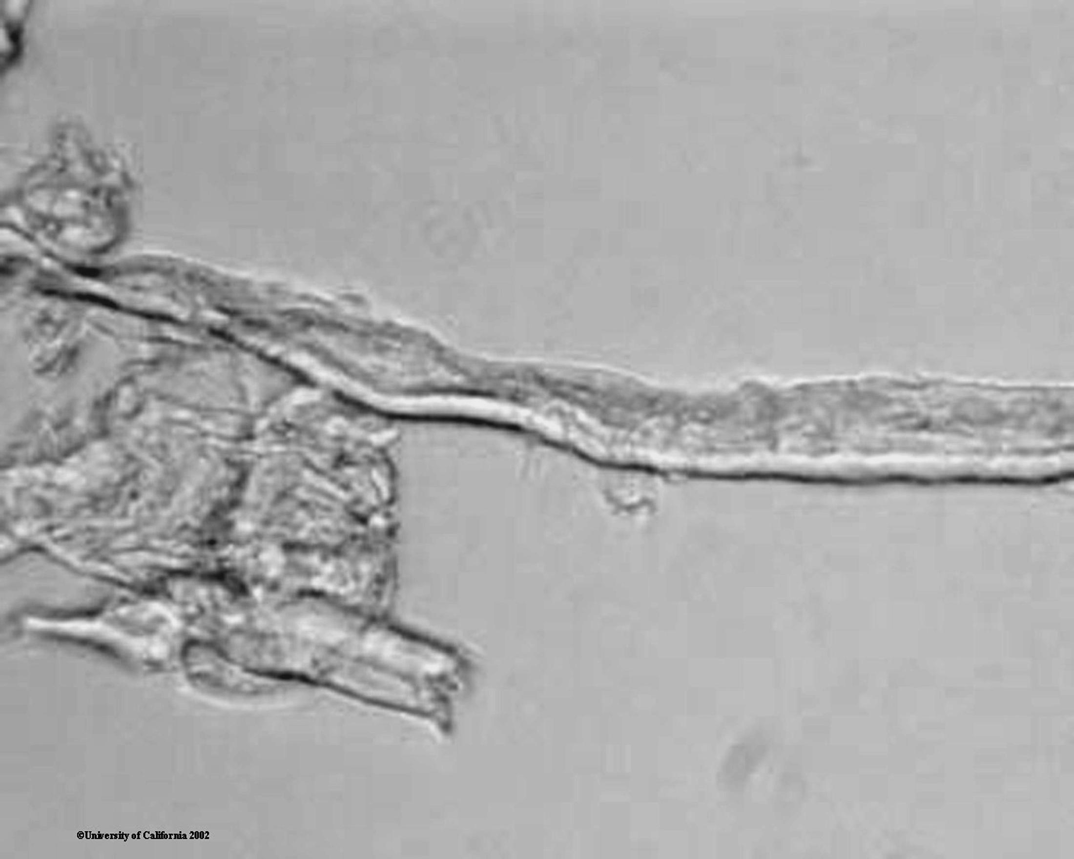  Cellulose Fibers 400X