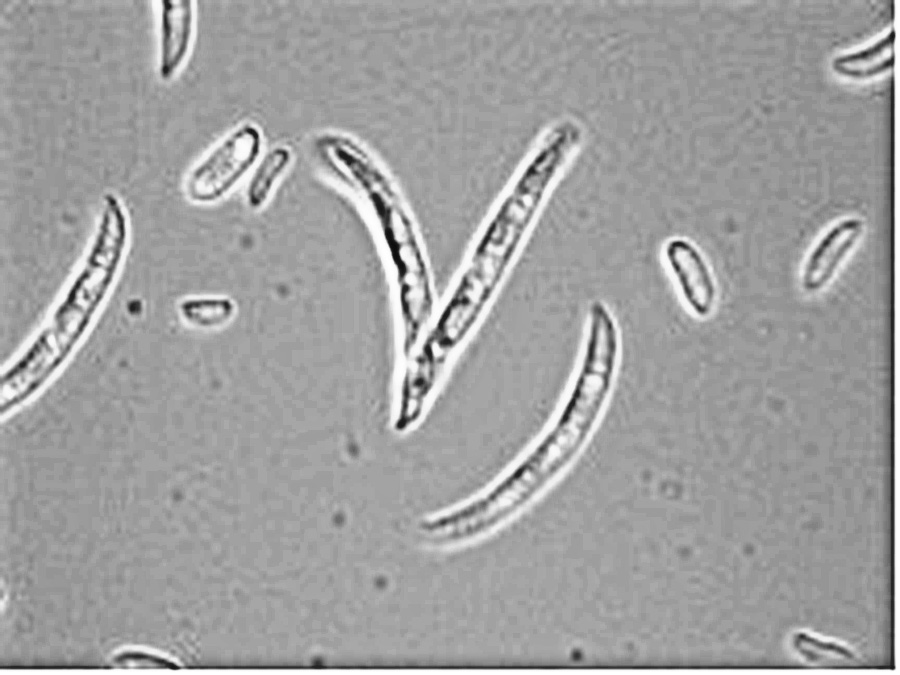 Fusarium spores at 400x magnification