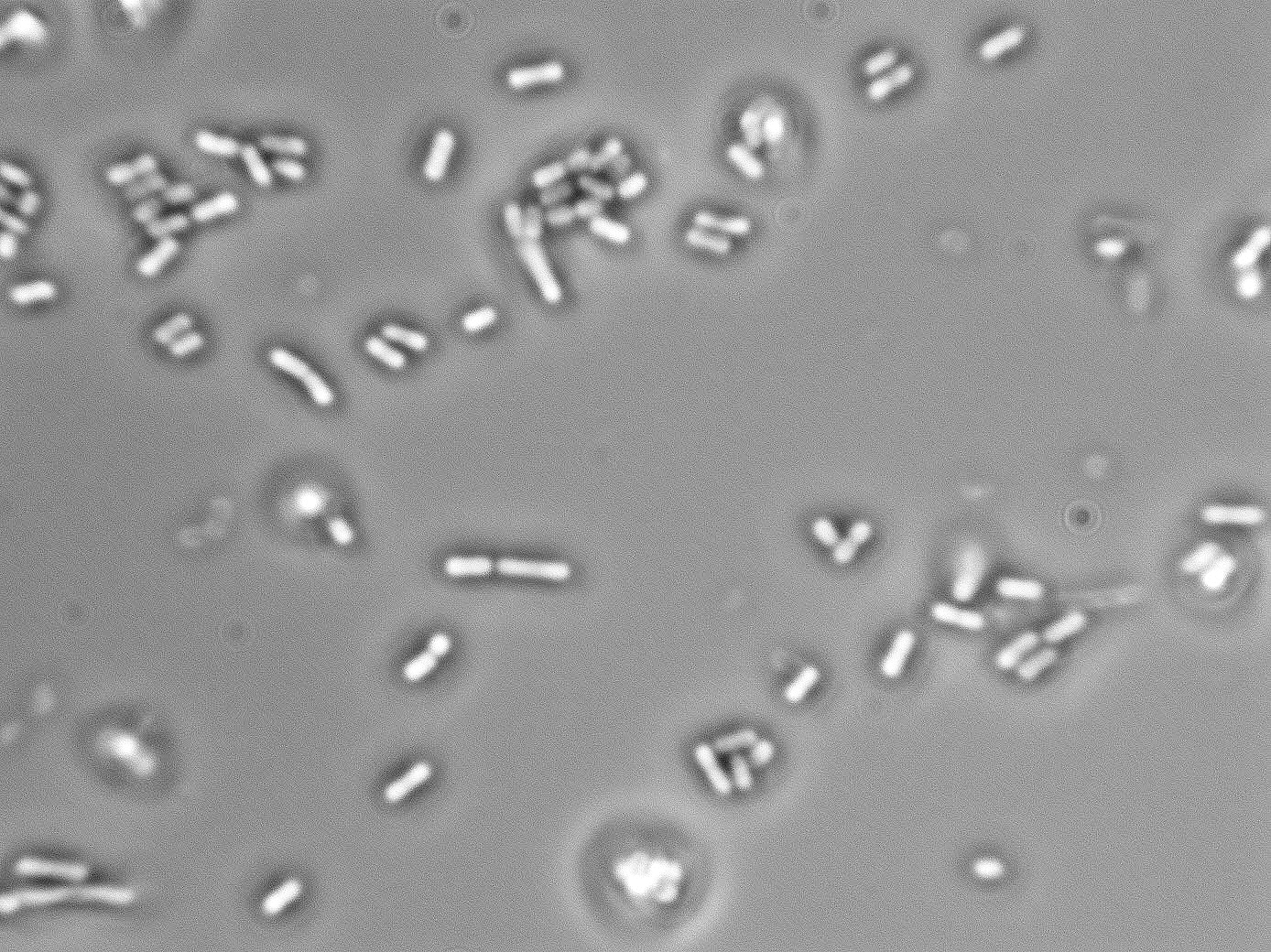 Lactobacillus casei