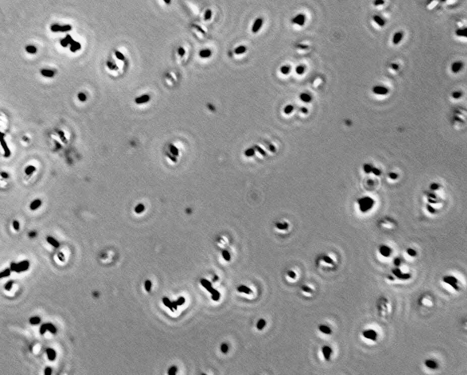 Lactobacillus casei