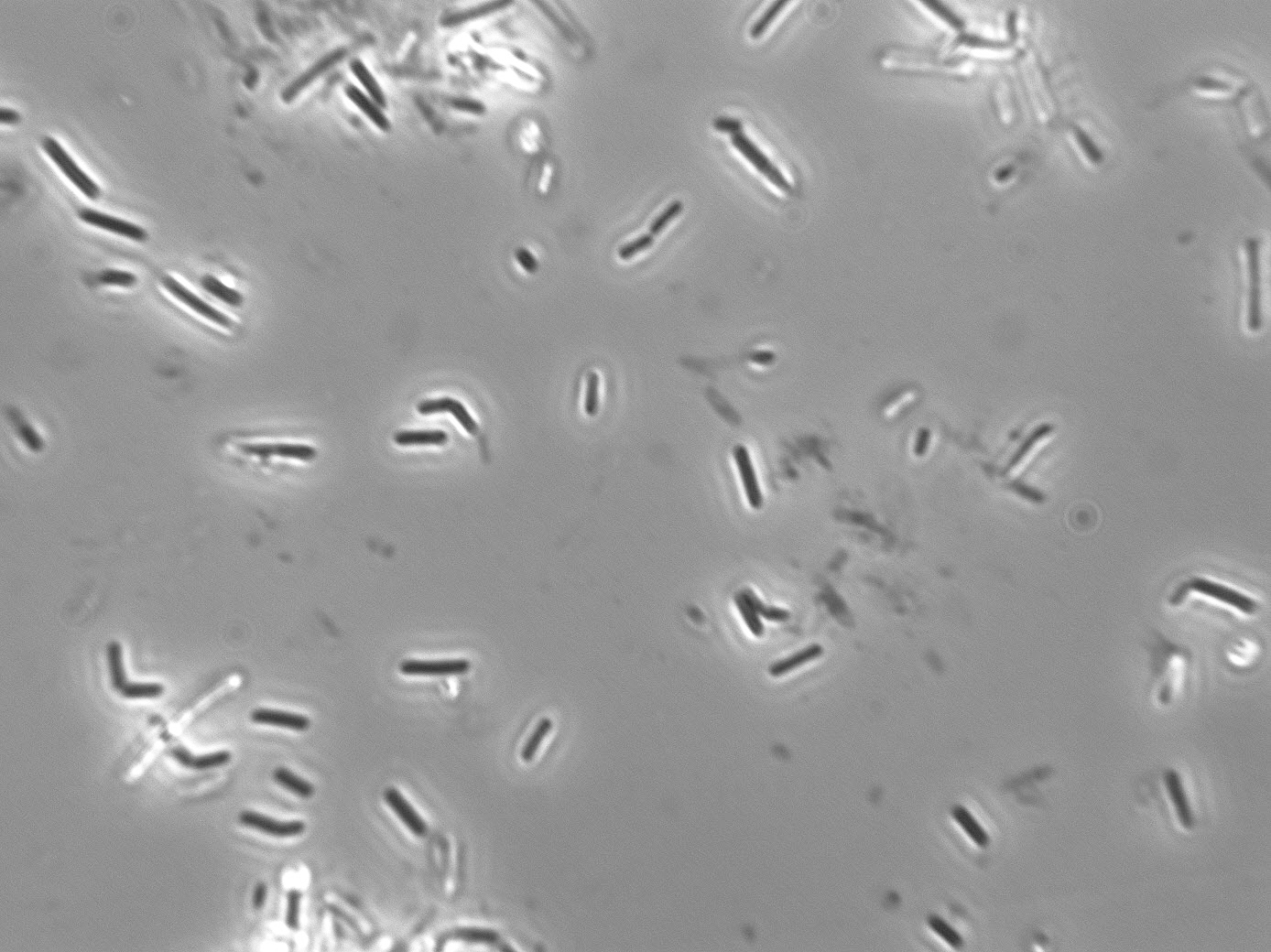 Lactobacillus delbrueckii