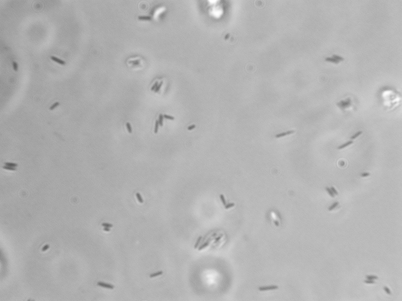Lactobacillus kunkeei