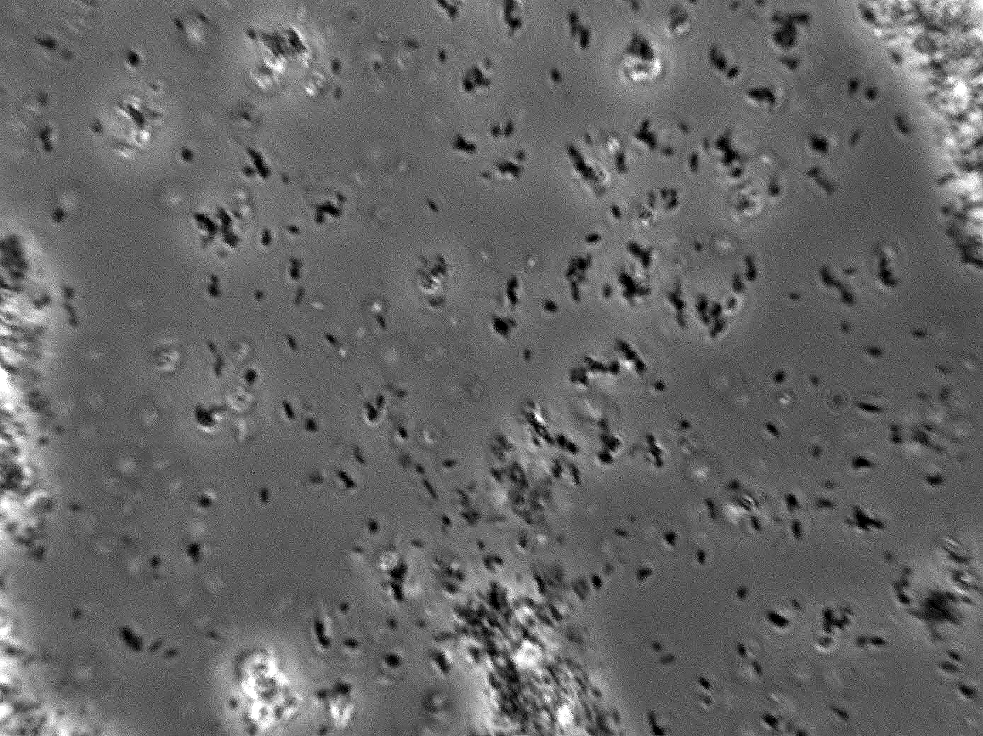 Lactobacillus kunkeei