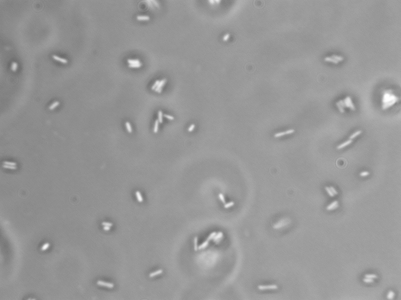 Lactobacillus kunkeei