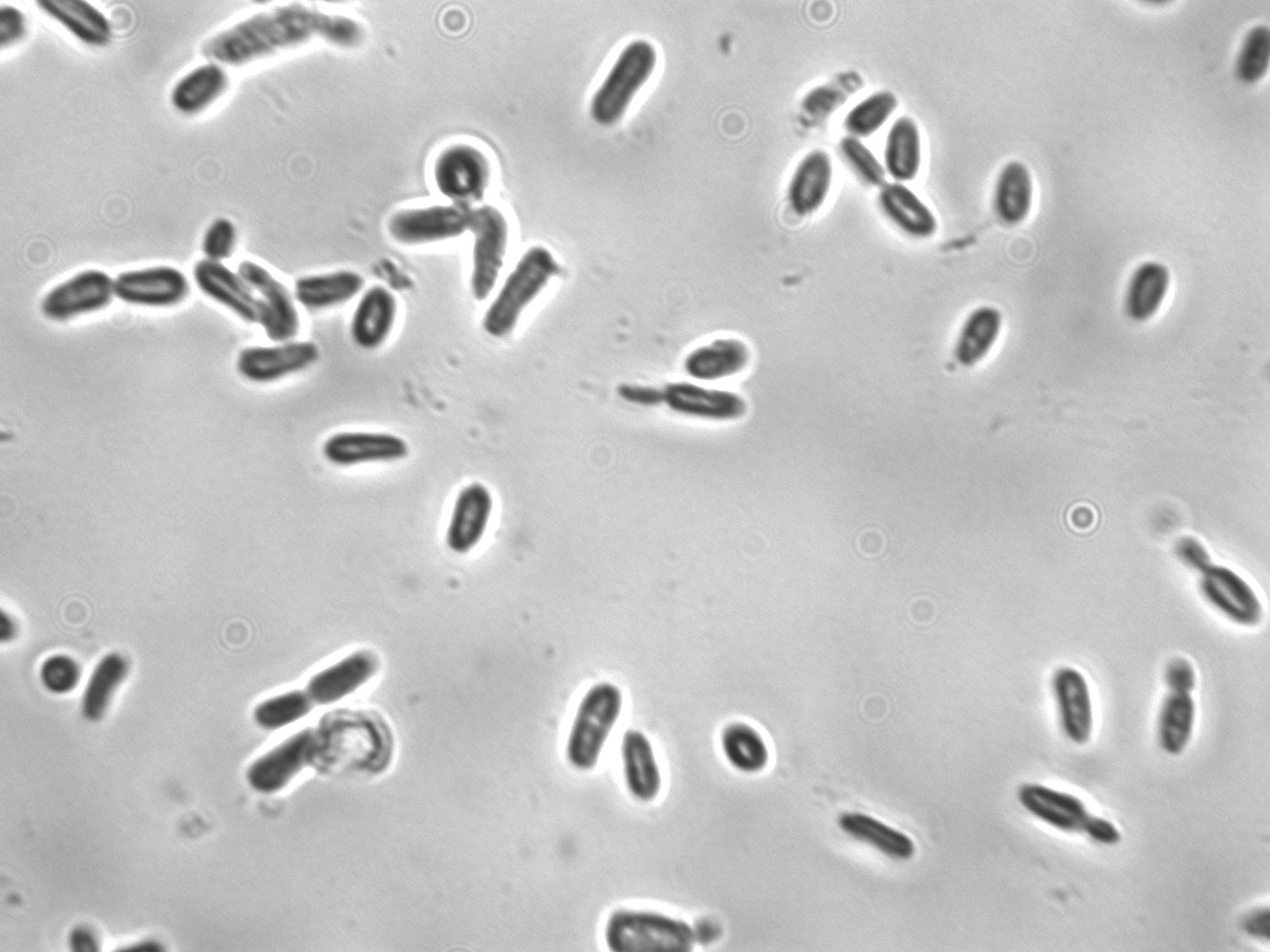 Saccharomyces bayanus at 1000x