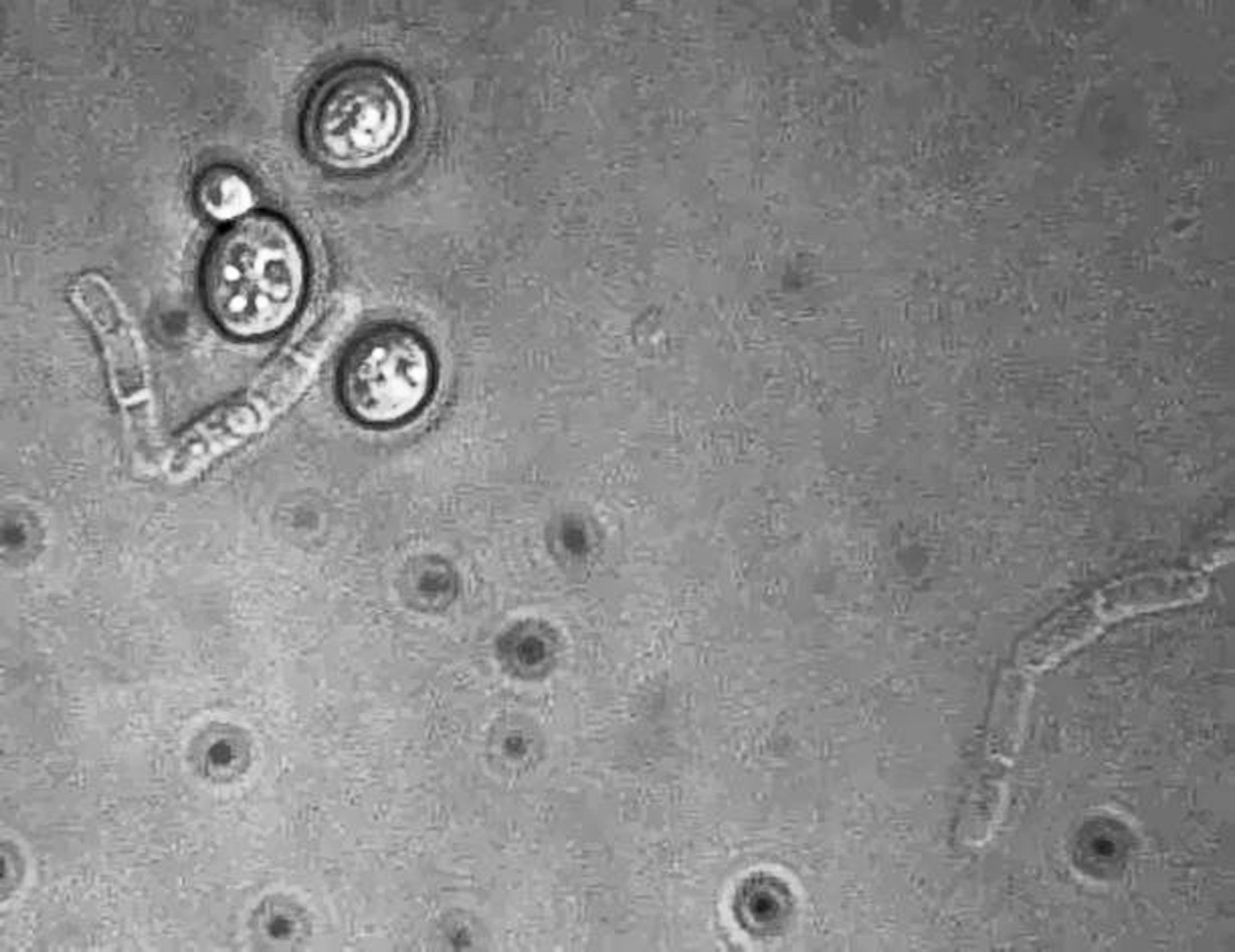 S. cerevisiae and B. megaterium