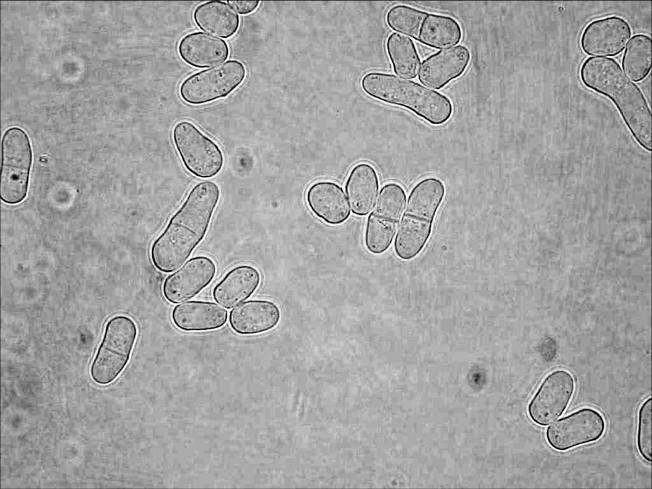 Schizosaccharomyces pombe 1000X