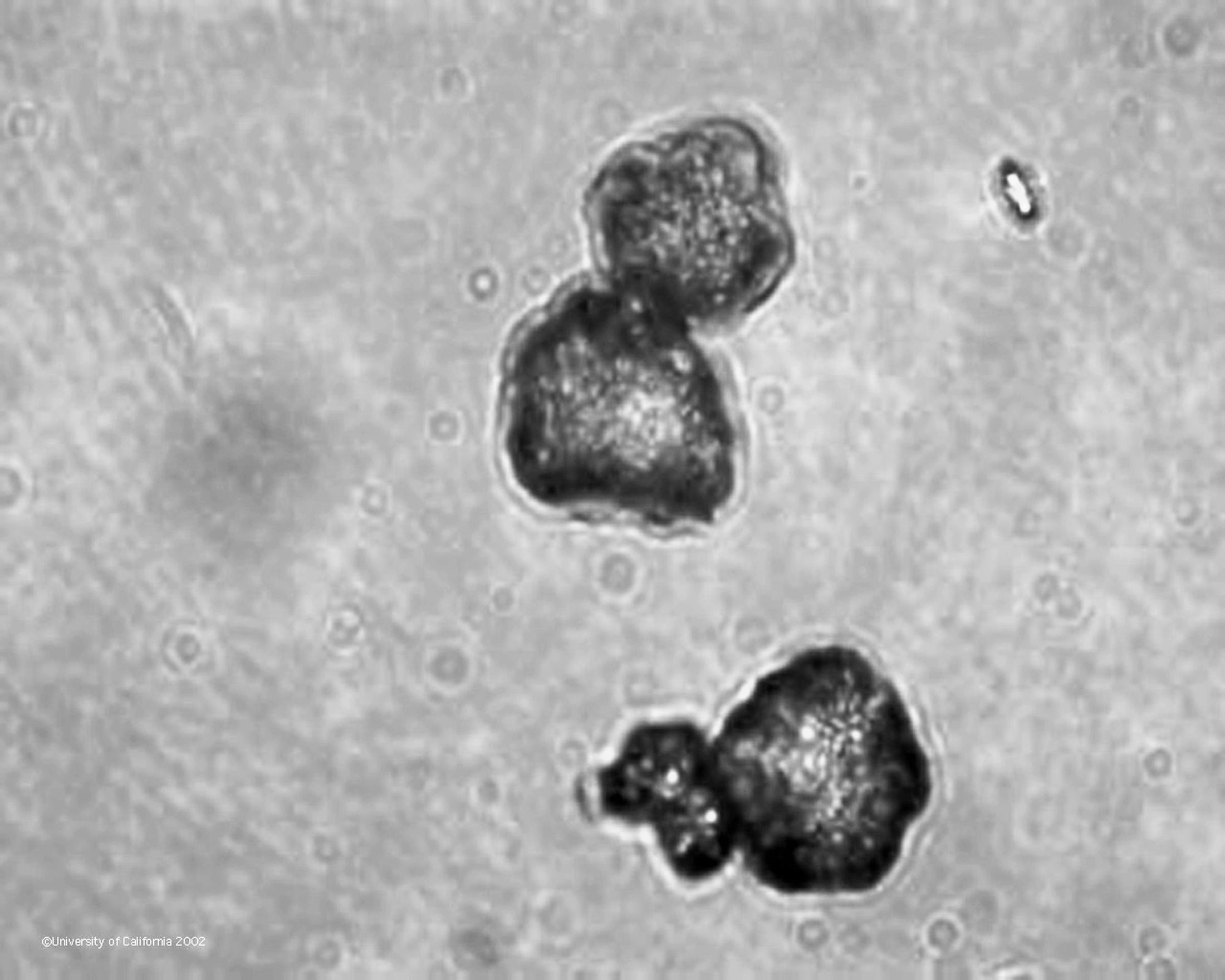Yeast Hulls 1000x