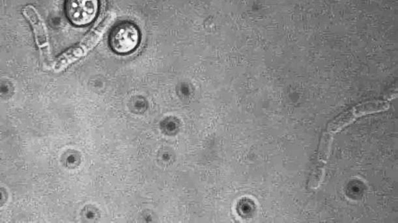 Microscopy